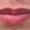 Lip Fillers - Before