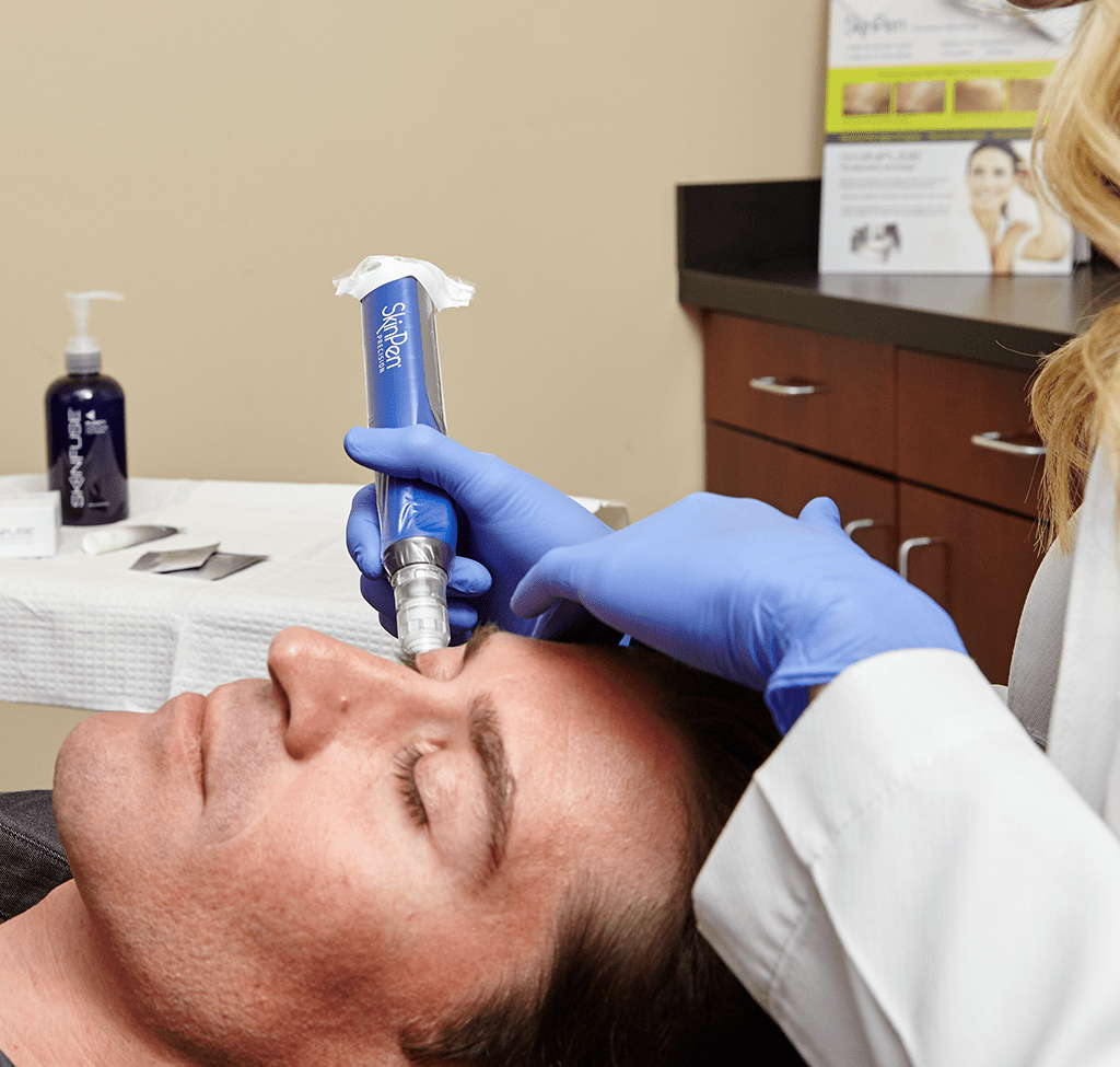 Microneedling Treatment at Cure Aesthetics Clinic