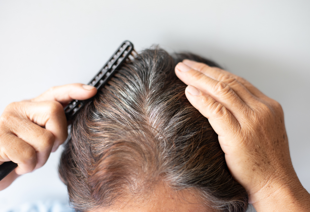 Service: Hair Restoration