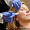 Microneedling Treatment at Cure Aesthetics Clinic